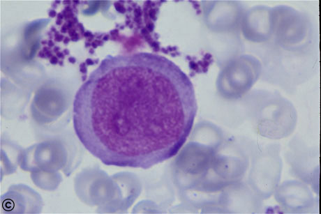 megaloblast.jpg